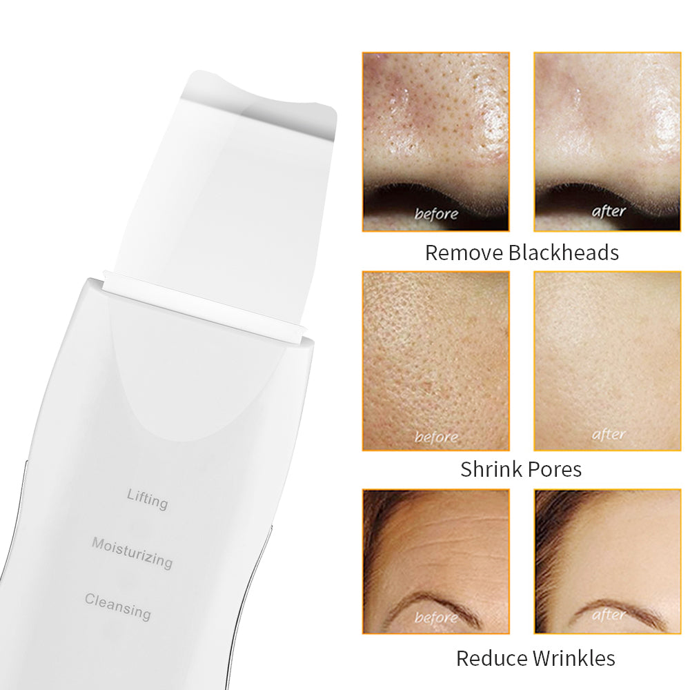 Limpiador Facial 3 en 1 Acné espinillas